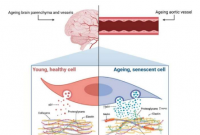 衰老和细胞外囊泡：血管淀粉样的新伙伴