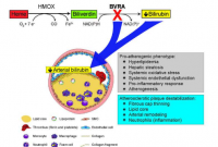 胆红素缺乏导致动脉粥样硬化斑块不稳定