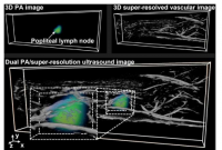 研究人员开发出新的低成本双模态成像技术 以促进早期疾病检测