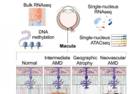 年龄相关性黄斑的新研究发现了致病基因