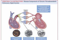 发现慢性血栓栓塞性肺血管疾病和左心疾病并不相互排斥