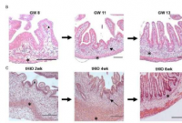 研究证实类器官是研究胎儿肠道发育的工具