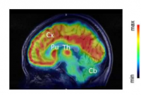 转化 PET 示踪剂使大脑胆固醇代谢可视化