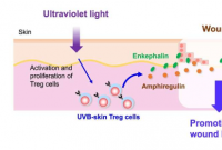 紫外线 B 暴露可增强脑啡肽原+调节性 T 细胞的愈合功能