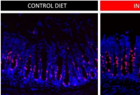 研究表明食用可溶性膳食纤维有利于肠上皮细胞的更新