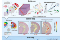 研究确定了大脑衰老的基因指纹