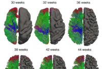 新软件如何改变我们对人类大脑发育的理解