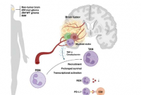 研究表明脑肿瘤控制某些免疫细胞变成
