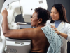 为什么女性应该在 40 岁开始接受乳房 X 光检查