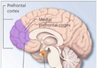 患有 PTSD 并患有睡眠呼吸暂停的患者可能会降低生活质量