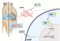 新研究揭示了 IL-17 在骨关节炎发病机制中的作用