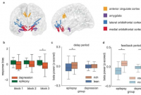 揭示抑郁症的新颖独特的神经特征