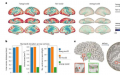 人类大脑的新模板增强了神经影像数据分析