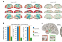人类大脑的新模板增强了神经影像数据分析
