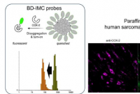 新型分子传感器可通过荧光成像评估肉瘤严重程度