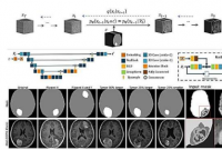 人工智能模型可以生成 3D 脑部 MRI 图像 同时解决数据稀缺和隐私问题