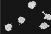 科学家发现特殊免疫细胞可阻止转移性癌症