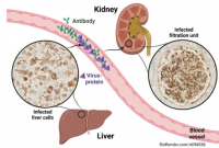揭示肝炎与肾脏损害之间的联系
