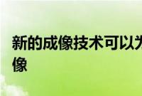 新的成像技术可以为肿瘤学家提供更清晰的图像